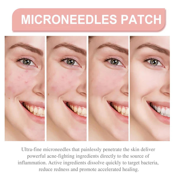 Derma Smooth Skin Tag Removal Patch